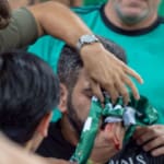 אוהד שנפגע באפו מכדור – 01/09/2018 (צילום: ירון כרמי)