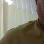 הפנים הנפוחות של אסף לוי שהותקף בכניסה לעכו (צילום עצמי)