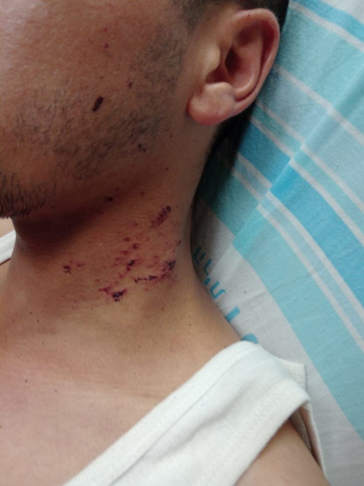 תאמר קוזלי - נהג אגד שנפצע בהתקפת אבנים ברחוב נווה שאנן בחיפה (אלבום אישי)