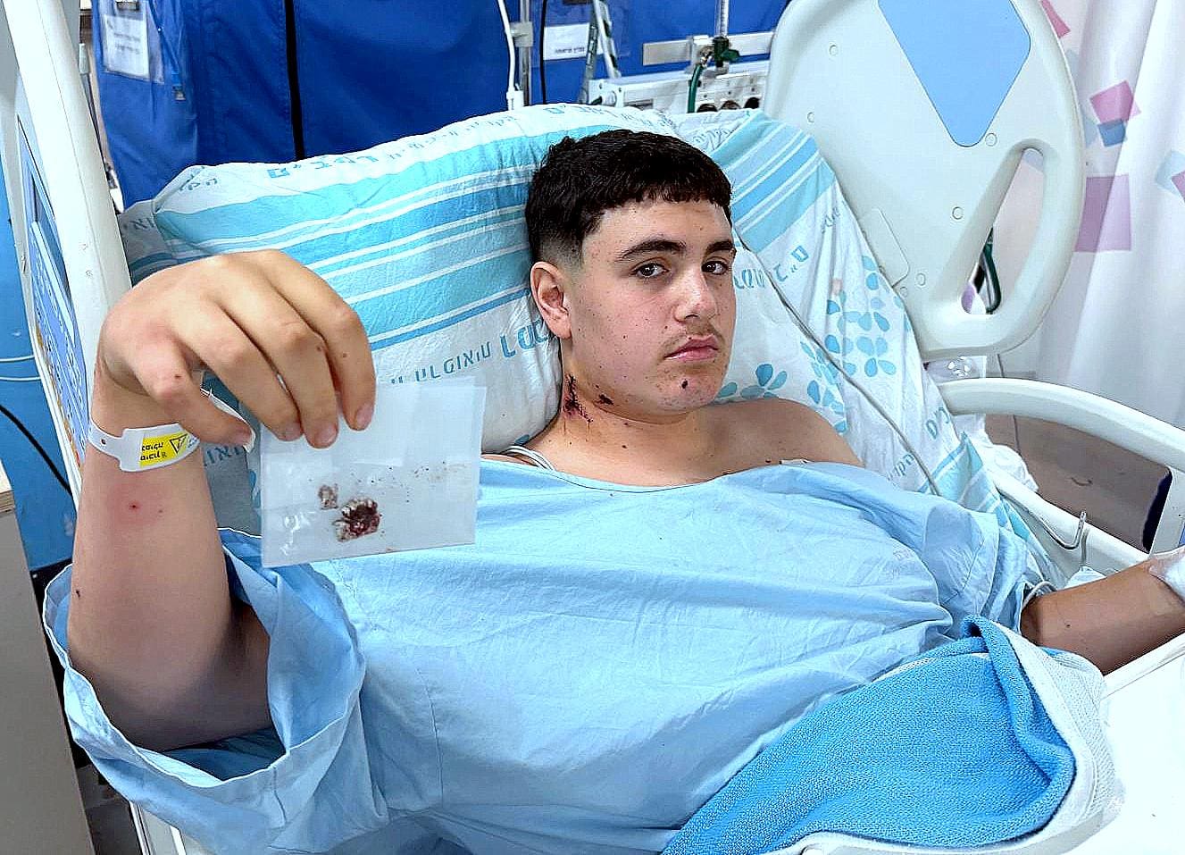 איתי מחזיק את 2 הרסיסים שהרופאים העניקו לו למשמרת, הרסיסים מייד עם הוצאתם בחדר הניתוח (צילום: דוברות רמב