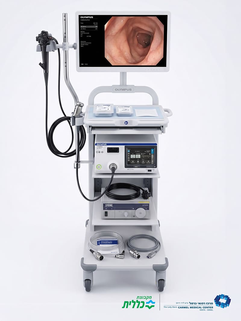 המערכת האנדוסקופית החדשה של Olympus שנרכשה לזכר רעייתו ויויאן ז"ל ומסייעת באבחון גידולים. (צילום: אלי דדון)